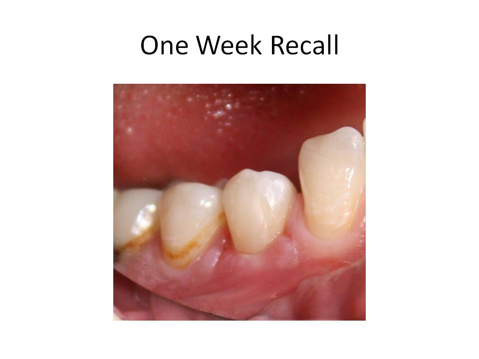 OneWeekRecall.jpg