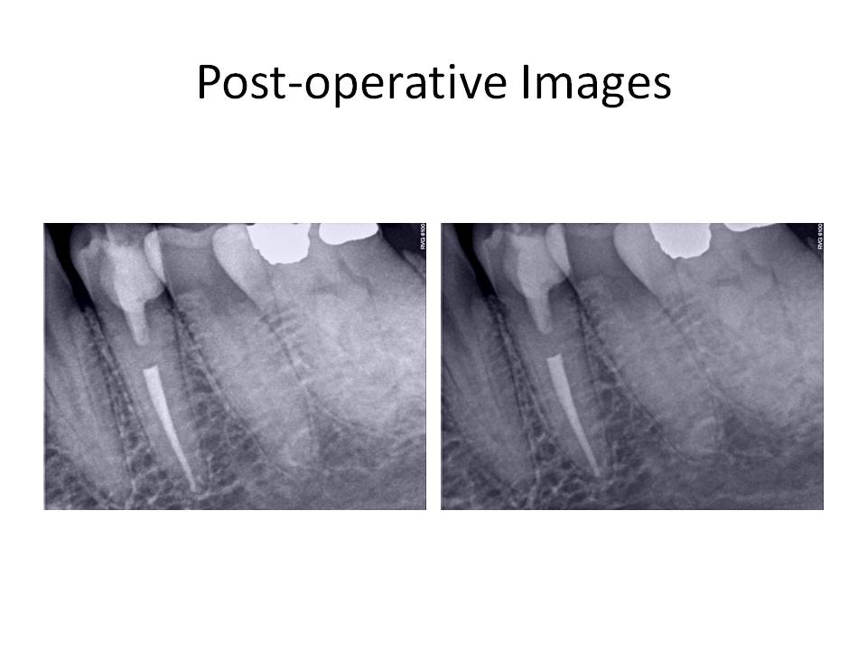 Post-operativeImages.jpg