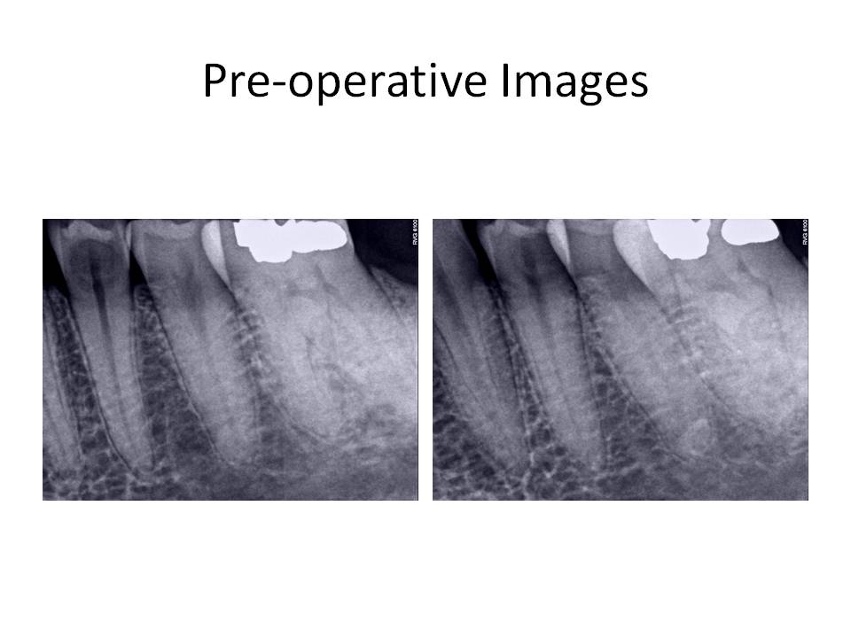 Pre-operativeImages.jpg